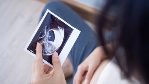 Welche Erfolgsaussichten hat eine Kinderwunschbehandlung?